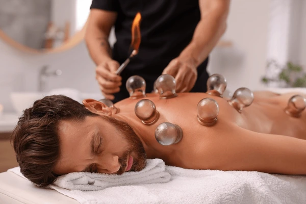 therapist-giving-fire-cupping-treatment-600nw-2399847407
